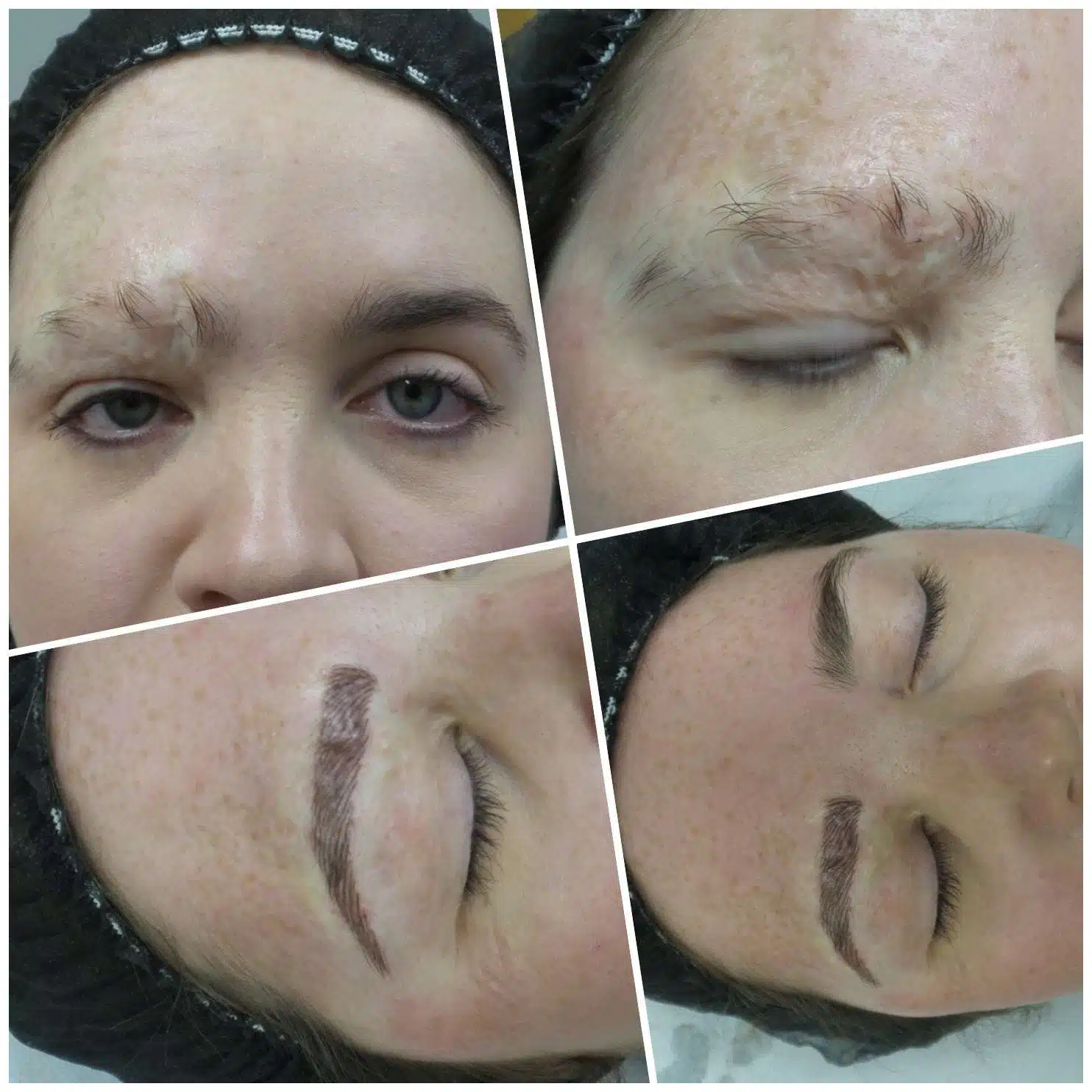 Medical Tattooing Manchester