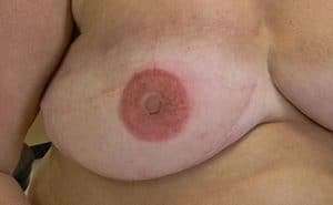 Areola tattoo manchester