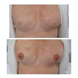 a tattoo on the areola done by marcia in manchester